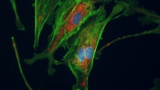 Bovine Pulmonary Alveolar Epithelia Cells